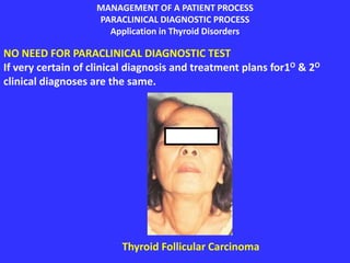 MANAGEMENT OF A PATIENT PROCESS
PARACLINICAL DIAGNOSTIC PROCESS
Application in Thyroid Disorders
NO NEED FOR PARACLINICAL DIAGNOSTIC TEST
If very certain of clinical diagnosis and treatment plans for1O & 2O
clinical diagnoses are the same.
Thyroid Follicular Carcinoma
 