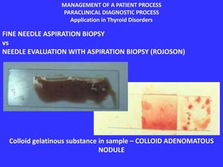 MANAGEMENT OF A PATIENT PROCESS
PARACLINICAL DIAGNOSTIC PROCESS
Application in Thyroid Disorders
FINE NEEDLE ASPIRATION BIOPSY
vs
NEEDLE EVALUATION WITH ASPIRATION BIOPSY (ROJOSON)
Colloid gelatinous substance in sample – COLLOID ADENOMATOUS
NODULE
 