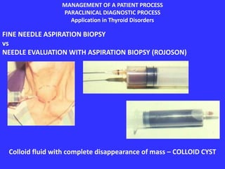 MANAGEMENT OF A PATIENT PROCESS
PARACLINICAL DIAGNOSTIC PROCESS
Application in Thyroid Disorders
FINE NEEDLE ASPIRATION BIOPSY
vs
NEEDLE EVALUATION WITH ASPIRATION BIOPSY (ROJOSON)
Colloid fluid with complete disappearance of mass – COLLOID CYST
 
