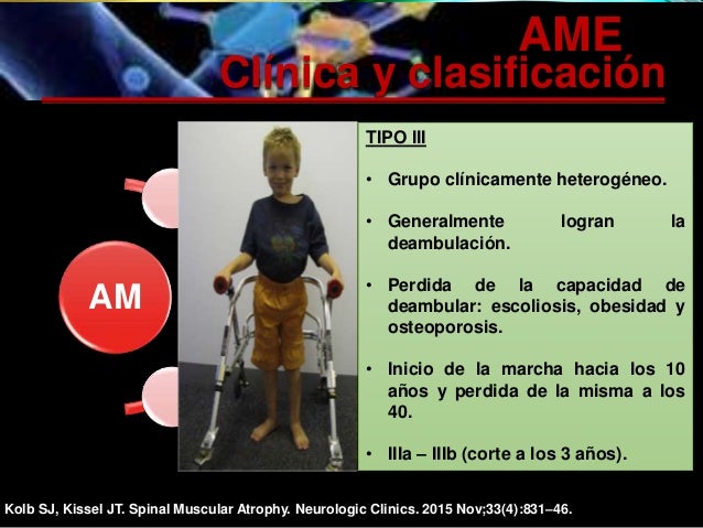 Atrofia muscular espinal