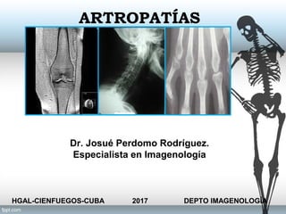 ARTROPATÍAS
.
Dr. Josué Perdomo Rodríguez.
Especialista en Imagenología
HGAL-CIENFUEGOS-CUBA 2017 DEPTO IMAGENOLOGÍA
 