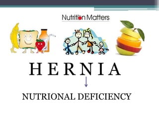 HERNIA
NUTRIONAL DEFICIENCY

 