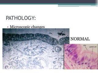 PATHOLOGY:
• Microscopic changes

NORMAL

 