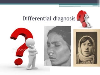 Differential diagnosis

 