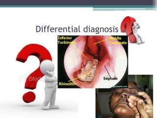 Differential diagnosis

 