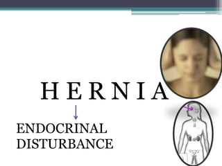 HERNIA
ENDOCRINAL
DISTURBANCE

 