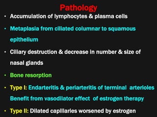 Pathology
• Accumulation of lymphocytes & plasma cells
• Metaplasia from ciliated columnar to squamous
epithelium
• Ciliary destruction & decrease in number & size of
nasal glands
• Bone resorption
• Type I: Endarteritis & periarteritis of terminal arterioles
Benefit from vasodilator effect of estrogen therapy
• Type II: Dilated capillaries worsened by estrogen
 