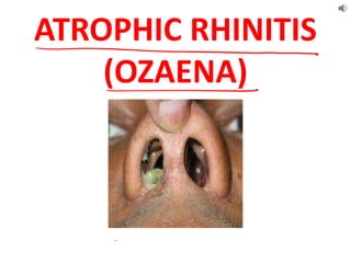 ATROPHIC RHINITIS
(OZAENA)
 