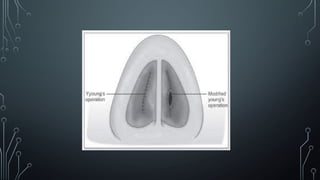ATROPHIC RHINITIS.pptx/rhinitis/atrophic | PPTX