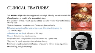 This presentation is about Atrophic Rhinitis | PPTX