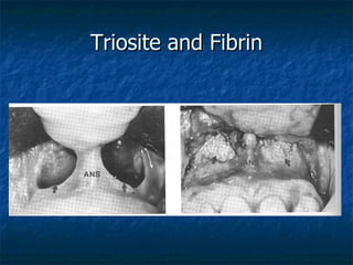 Triosite and Fibrin 