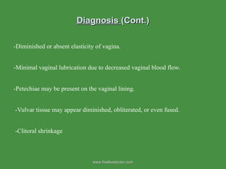 Diagnosis  (Cont.) -Diminished or absent elasticity of vagina. -Minimal vaginal lubrication due to decreased vaginal blood flow. -Petechiae may be present on the vaginal lining. -Vulvar tissue may appear diminished, obliterated, or even fused. -Clitoral shrinkage  www.freelivedoctor.com 