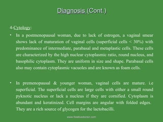Diagnosis  (Cont.) 4- Cytology : In a postmenopausal woman, due to lack of estrogen, a vaginal smear shows lack of maturation of vaginal cells (superficial cells < 30%) with predominance of intermediate, parabasal and metaplastic cells. These cells are characterized by the high nuclear cytoplasmic ratio, round nucleus, and basophilic cytoplasm. They are uniform in size and shape. Parabasal cells also may contain cytoplasmic vacuoles and are known as foam cells.  In premenopausal & younger woman, vaginal cells are mature. i.e superficial. The superficial cells are large cells with either a small round pyknotic nucleus or lack a nucleus if they are cornified. Cytoplasm is abundant and keratinized. Cell margins are angular with folded edges.  They are a rich source of glycogen for the lactobacilli. www.freelivedoctor.com 
