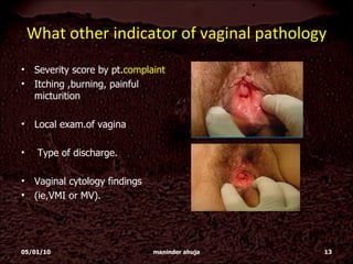 What other indicator of vaginal pathology Severity score by pt. complaint Itching ,burning, painful micturition Local exam.of vagina  Type of discharge. Vaginal cytology findings  (ie,VMI or MV).  05/01/10 maninder ahuja 