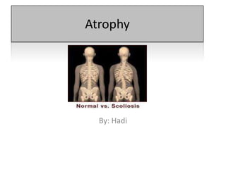 Atrophy | PPTX