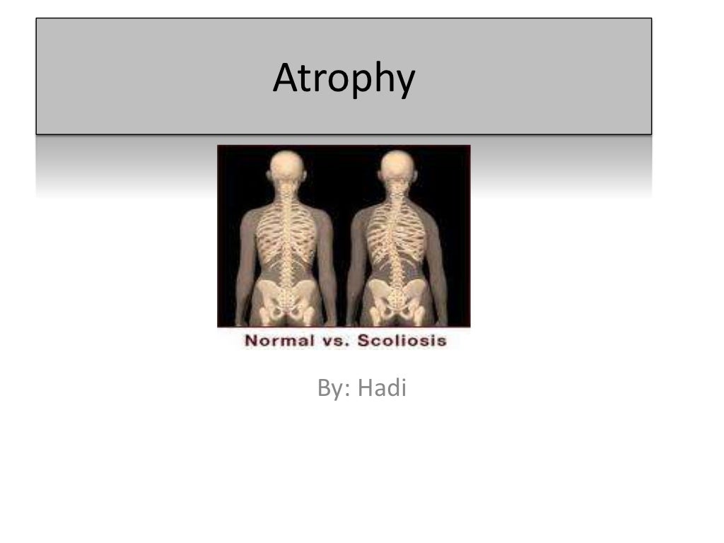Atrophy