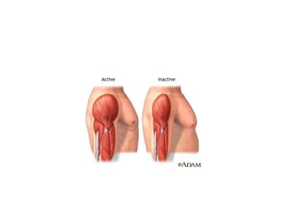 Atrophy | PPTX