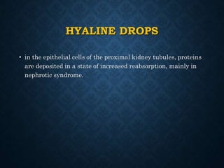 HYALINE DROPS
• in the epithelial cells of the proximal kidney tubules, proteins
are deposited in a state of increased reabsorption, mainly in
nephrotic syndrome.
 