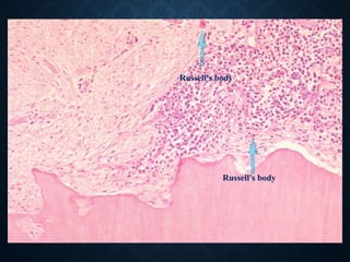 Russell's body
Russell's body
 