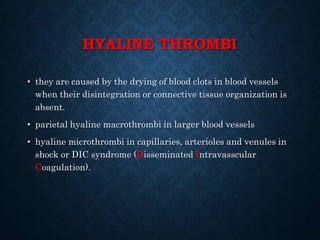 HYALINE THROMBI
• they are caused by the drying of blood clots in blood vessels
when their disintegration or connective tissue organization is
absent.
• parietal hyaline macrothrombi in larger blood vessels
• hyaline microthrombi in capillaries, arterioles and venules in
shock or DIC syndrome (Disseminated Intravasscular
Coagulation).
 