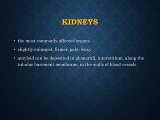 KIDNEYS
• the most commonly affected organs
• slightly enlarged, firmer, pale, waxy
• amyloid can be deposited in glomeruli, interstitium, along the
tubular basement membrane, in the walls of blood vessels
 