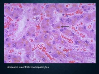 Lipofuscin in central zone hepatocytes
 