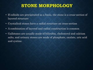 STONE MORPHOLOGY
• If colloids are precipitated as a basis, the stone is a cross-section of
layered structure
• Crystalloid stones have a radial structure on cross-section
• A combination of layered and radial construction is common
• Gallstones are usually made of bilirubin, cholesterol and calcium
salts, and urinary stones are made of phosphate, oxalate, uric acid
and cystine.
 