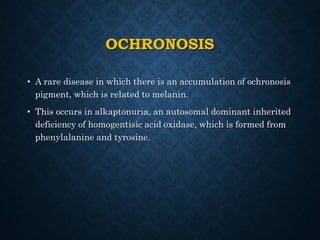 OCHRONOSIS
• A rare disease in which there is an accumulation of ochronosis
pigment, which is related to melanin.
• This occurs in alkaptonuria, an autosomal dominant inherited
deficiency of homogentisic acid oxidase, which is formed from
phenylalanine and tyrosine.
 