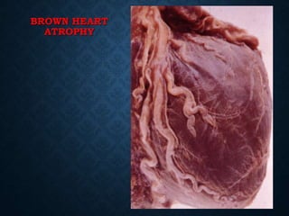 BROWN HEART
ATROPHY
 