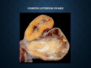 CORPUS LUTHEUM OVARII
 