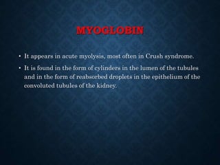 MYOGLOBIN
• It appears in acute myolysis, most often in Crush syndrome.
• It is found in the form of cylinders in the lumen of the tubules
and in the form of reabsorbed droplets in the epithelium of the
convoluted tubules of the kidney.
 