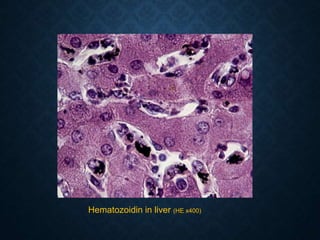 Hematozoidin in liver (HE x400)
 