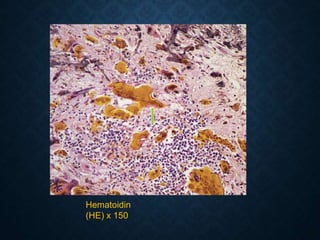 Hematoidin
(HE) x 150
 