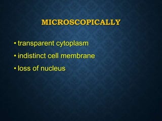 MICROSCOPICALLY
• transparent cytoplasm
• indistinct cell membrane
• loss of nucleus
 