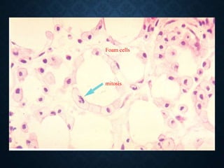Foam cells
mitosis
 