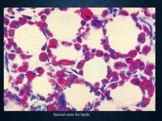 Special stain for lipids
 