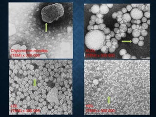 Chylomicron-micelles
(TEM) x 300 000
VLDL
(TEM) x 300 000
LDL
(TEM) x 300 000
HDL
(TEM) x 300 000
 