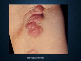 Tuberous xanthomas
 
