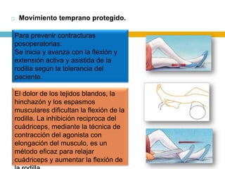 

Movimiento temprano protegido.

Para prevenir contracturas
posoperatorias:
Se inicia y avanza con la flexión y
extensión activa y asistida de la
rodilla según la tolerancia del
paciente.
El dolor de los tejidos blandos, la
hinchazón y los espasmos
musculares dificultan la flexión de la
rodilla. La inhibición reciproca del
cuádriceps, mediante la técnica de
contracción del agonista con
elongación del musculo, es un
método eficaz para relajar
cuádriceps y aumentar la flexión de

 