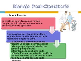 

Inmovilización.

La rodilla se inmoviliza con un vendaje
compresivo voluminoso durante un día o
dos después de la operación.

Después de quitar el vendaje abultado,
se suele llevar una férula posterior de la
rodilla para el ejercicio diario.
La artroplastia sin cemento tal vez
requiera un período de inmovilización
más largo que el procedimiento con
cemento para permitir la
osteointegración con hueso de la
prótesis. Puede estar indicada una férula
posterior de rodilla para su uso de noche
hasta 12 semanas después de la

 