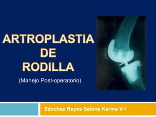 Efectos prehabilitación postoperatoria en pacientes artroplastia total  rodilla - Ecufis - Cursos presenciales y online para Fisioterapeutas