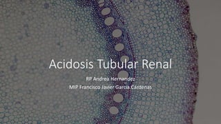 Acidosis Tubular Renal
RP Andrea Hernandez
MIP Francisco Javier García Cárdenas
 