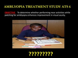 AMBLYOPIA TREATMENT STUDY ATS 6
OBJECTIVE To determine whether performing near activities while
patching for amblyopia enh...