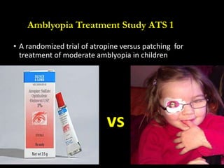 Amblyopia Treatment Study ATS 1
• A randomized trial of atropine versus patching for
treatment of moderate amblyopia in ch...