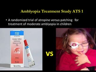 Amblyopia treatment study (ATS) for children | PPT