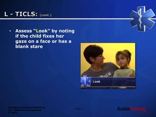 Emergency Medical Technician
20 – Pediatric Emergencies
© 2014
• Assess “Look” by noting
if the child fixes her
gaze on a face or has a
blank stare
Slide 17
 