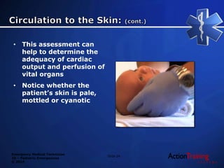 Emergency Medical Technician
20 – Pediatric Emergencies
© 2014
• This assessment can
help to determine the
adequacy of cardiac
output and perfusion of
vital organs
• Notice whether the
patient’s skin is pale,
mottled or cyanotic
Slide 24
 