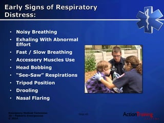 Emergency Medical Technician
20 – Pediatric Emergencies
© 2014
• Noisy Breathing
• Exhaling With Abnormal
Effort
• Fast / Slow Breathing
• Accessory Muscles Use
• Head Bobbing
• “See-Saw” Respirations
• Tripod Position
• Drooling
• Nasal Flaring
Slide 49
 