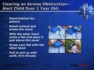 Emergency Medical Technician
20 – Pediatric Emergencies
© 2014
• Stand behind the
patient
• Reach around and
locate the navel
• With the other hand
make a fist and place it
just above the navel
• Grasp your fist with the
other hand
• Pull in and up with
swift, firm thrusts
Slide 62
 