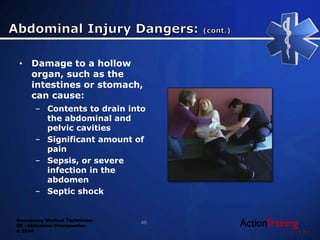 Emergency Medical Technician
22 - Abdominal Emergencies
© 2014
• Damage to a hollow
organ, such as the
intestines or stomach,
can cause:
– Contents to drain into
the abdominal and
pelvic cavities
– Significant amount of
pain
– Sepsis, or severe
infection in the
abdomen
– Septic shock
46
 